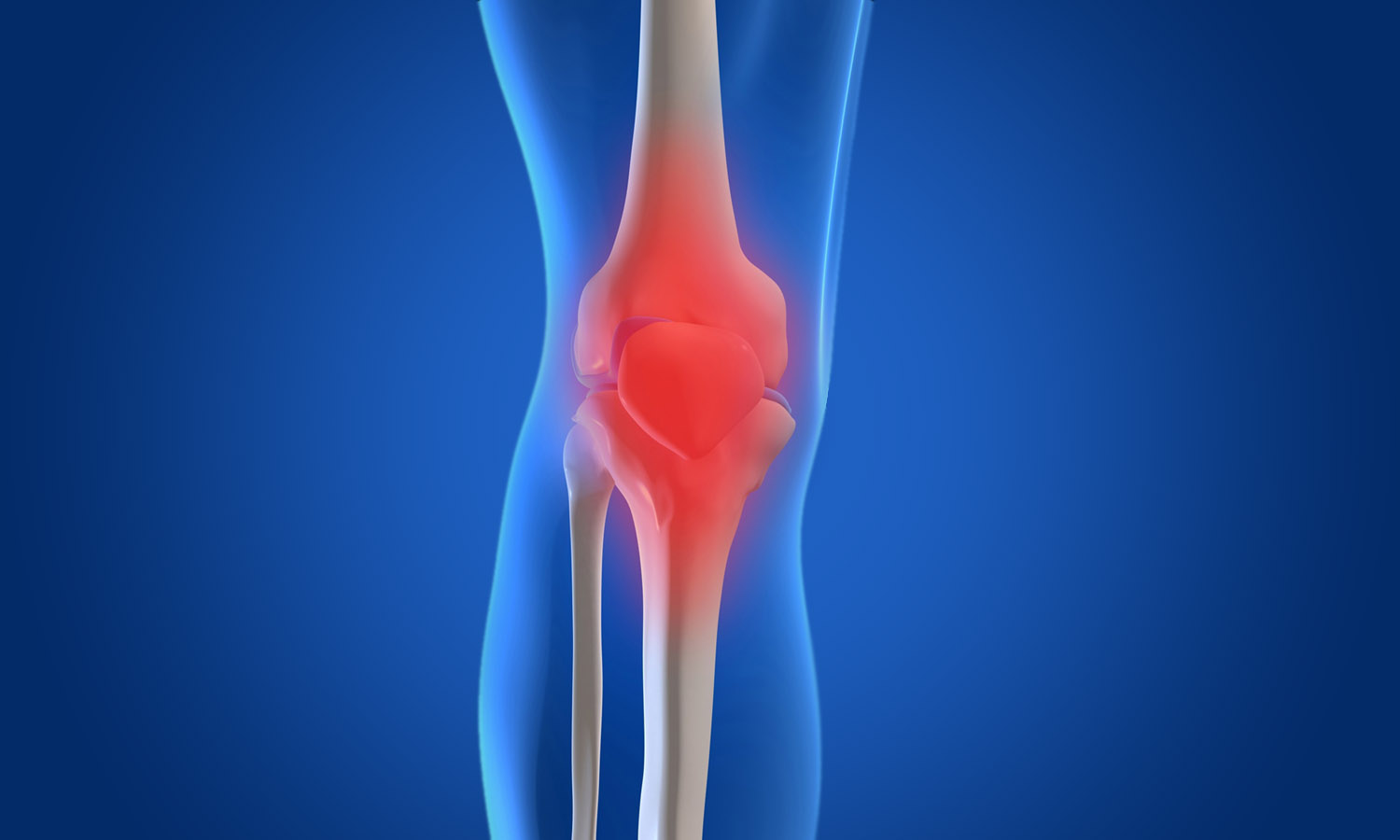 How is Osteoarthritis treated? How is Osteoarthritis treated?