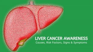Liver Cancer Symptoms