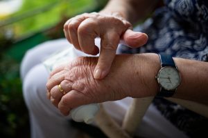 How to Treat Arthritis at Home