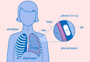 The Mesothelioma Cancer From Asbestos Exposure Risk Factors