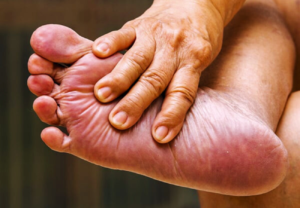 Why Checking Diabetic Foot Matters